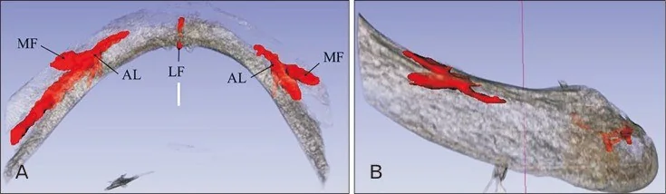 Mental foramen ve mandibular kanal varyantları: yayımlanmış olgu görüntüsü, 3B kesit