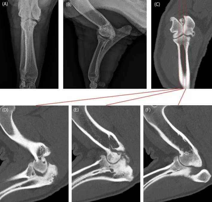 Dirsek osteoartriti ve osteofitler: yayımlanmış olgu görüntüsü, sagittal kesit