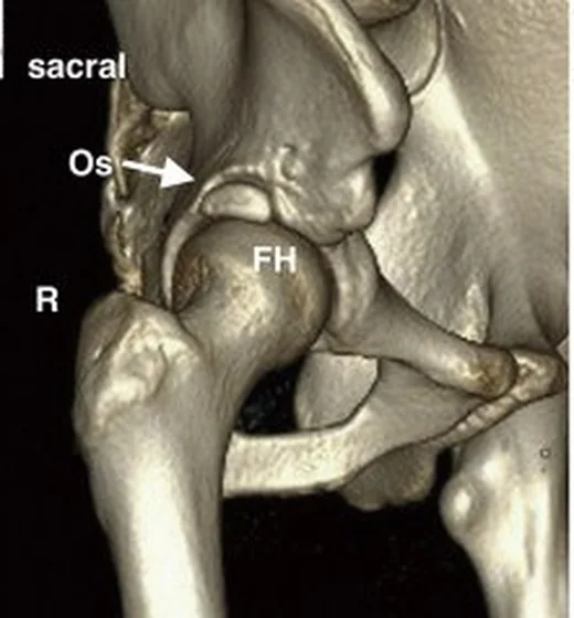Os acetabuli ve asetabular rim ossikülü: yayımlanmış olgu görüntüsü, sagittal kesit